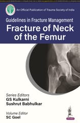 Guidelines in Fracture Management Fracture of Neck of the Femur 1st Edition 2024 By GS Kulkarni