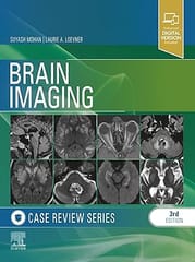 Brain Imaging Case Review Series With Access Code 3rd Edition 2024 By Suyash Mohan