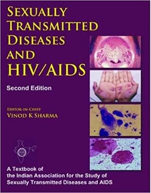 Sexually Transmitted Diseases and HIV/AIDS 2nd Edition By Vinod K Sharma