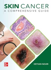 Skin Cancer A Comprehensive Guide 1st Edition 2023 By Keyvan Nouri