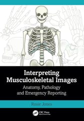 Interpreting Musculoskeletal Images Anatomy Pathology And Emergency Reporting  2024 By Jones R