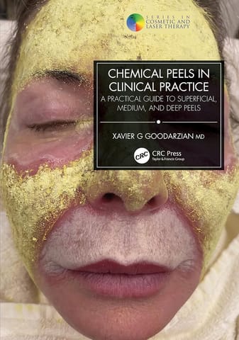 Chemical Peels In Clinical Practice A Practical Guide To Superficial Medium And Deep Peels  2024 By Goodarzian X G