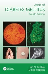Atlas Of Diabetes Mellitus 4th Edition 2024 By Scobie I N
