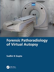 Forensic Pathoradiology Of Virtual Autopsy  2024 By Gupta S K