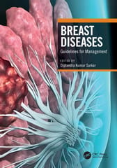 Breast Diseases Guidelines For Management  2024 By Sarkar D K
