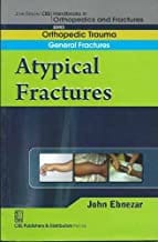 John Ebnezar Series: Atypical Fractures 2012 By Ebnezar John