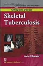 John Ebnezar CBS Handbooks in Orthopedics and Fractures: Orthopedic Disease : Skeletal Tuberculosis 2012 By Ebnezar John