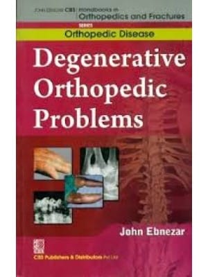 John Ebnezar CBS Handbooks in Orthopedics and Fractures: Orthopedic Disease :Degenerative Orthopedic Problems 2012 By Ebnezar John