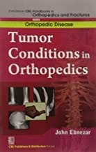 John Ebnezar CBS Handbooks in Orthopedics and Fractures: Orthopedic Disease :Tumor Conditions in Orthopedics  2012 By Ebnezar John