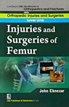 John Ebnezar CBS Handbooks in Orthopedics and Fractures: Orthopedic Injuries and Surgeries : Lower Limb : Injuries and Surgeries of Femur 2012 By Ebnezar John