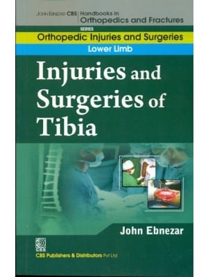 John Ebnezar CBS Handbooks in Orthopedics and Fractures: Orthopedic Injuries and Surgeries : Lower Limb : Injuries and Surgeries of Tibia 2012 By Ebnezar John