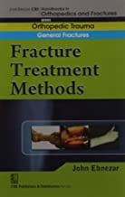 John Ebnezar CBS Handbooks in Orthopedics and Fractures: Orthopedic Trauma: General Fractures: Fracture Treatment Methods 2012 By Ebnezar John