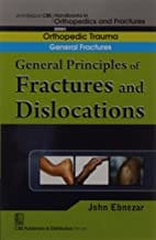 John Ebnezar CBS Handbooks in Orthopedics and Fractures: Orthopedic Trauma: General Fractures: General Principles of Fractures and Dislocations: 2012 By Ebnezar John