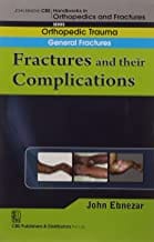 John Ebnezar CBS Handbooks in Orthopedics and Fractures: Orthopedic Trauma: General Fractures: Fractures and their Complications 2012 By Ebnezar John