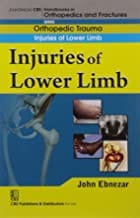 John Ebnezar CBS Handbooks in Orthopedics and Fractures: Orthopedic Trauma: Injuries of Lower Limb 2012 By Ebnezar John
