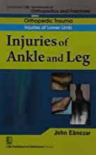 John Ebnezar CBS Handbooks in Orthopedics and Fractures: Orthopedic Trauma: Injuries of Lower Limb :Injuries of Ankle and Leg 2012 By Ebnezar John
