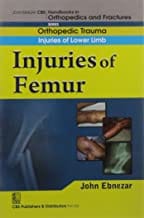 John Ebnezar CBS Handbooks in Orthopedics and Fractures: Orthopedic Trauma: Injuries of Lower Limb :Injuries of Femur 2012 By Ebnezar John