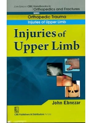 John Ebnezar CBS Handbooks in Orthopedics and Fractures: Orthopedic Trauma: Injuries of Upper Limb  2012 By Ebnezar John