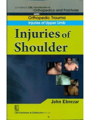 John Ebnezar CBS Handbooks in Orthopedics and Fractures: Orthopedic Trauma: Injuries of Upper Limb : Injuries of Shoulder 2012 By Ebnezar John