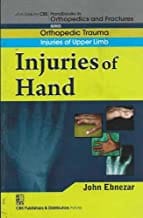 John Ebnezar CBS Handbooks in Orthopedics and Fractures: Orthopedic Trauma: Injuries of Upper Limb :Injuries of Hand 2012 By Ebnezar John