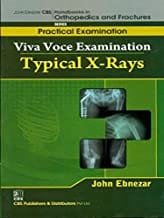 John Ebnezar CBS Handbooks in Orthopedics and Fractures: Practical Examination : Viva Voce Examination: Typical X-Rays  2012 By Ebnezar John