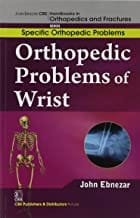 John Ebnezar CBS Handbooks in Orthopedics and Fractures: Specific Orthopedic Problems : Orthopedic Problems of  Wrist 2012 By Ebnezar John
