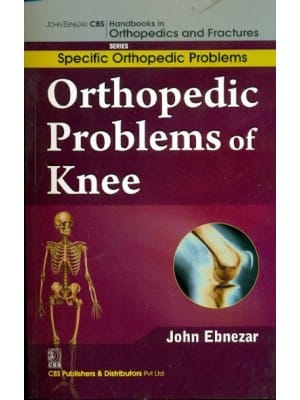 John Ebnezar CBS Handbooks in Orthopedics and Fractures: Specific Orthopedic Problems :Orthopedic Problems of  Knee 2012 By Ebnezar John
