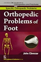 John Ebnezar CBS Handbooks in Orthopedics and Fractures: Specific Orthopedic Problems :Orthopedic Problems of  Foot 2012 By Ebnezar John