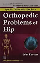 John Ebnezar CBS Handbooks in Orthopedics and Fractures: Specific Orthopedic Problems :Orthopedic Problems of  Hip 2012 By Ebnezar John