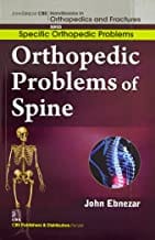 John Ebnezar CBS Handbooks in Orthopedics and Fractures: Specific Orthopedic Problems :Orthopedic Problems of  Spine 2012 By Ebnezar John