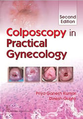 Colposcopy in Practical Gynecology, 2nd Edition 2017 By Kumar P G