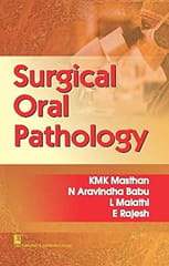 Surgical Oral Pathology 2016 By Masthan