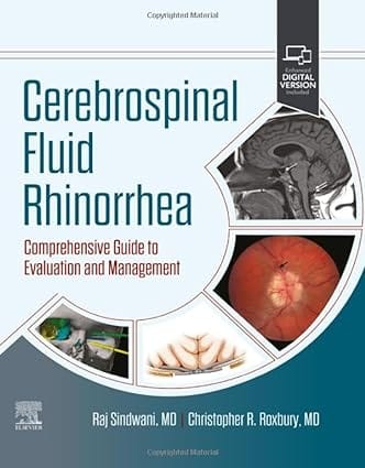 Cerebrospinal Fluid Rhinorrhea Comprehensive Guide To Evaluation And Management With Access Code  2024 By Sindwani R