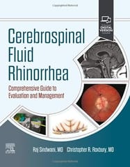 Cerebrospinal Fluid Rhinorrhea Comprehensive Guide To Evaluation And Management With Access Code  2024 By Sindwani R