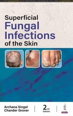 Superficial Fungal Infections Of The Skin 2nd Edition 2024 By Archana Singal