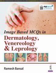 Image Based Mcq'S In Dermatology, Venereology & Leprology 1st Edition 2024 By Ramesh Bansal