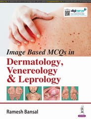 Image Based Mcq'S In Dermatology, Venereology & Leprology 1st Edition 2024 By Ramesh Bansal