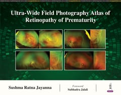 Ultra-Wide Field Photography Atlas of Retinopathy of Prematurity 1st Edition 2024 By Sushma Ratna Jayanna