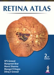 Retina Atlas 2nd Edition 2024 By SPS Grewal