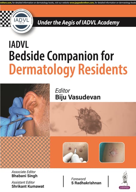 IADVL Bedside Companion for Dermatology Residents 1st Edition 2024 By Biju Vasudevan