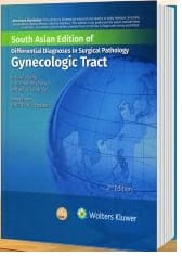 Differential Diagnoses in Surgical Pathology Gynecologic Tract, 2nd South Asia Edition 2024 By Vang R