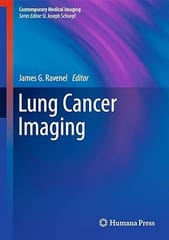 Lung Cancer Imaging 2013 By Ravenel J.G.