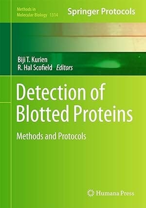 Detection Of Blotted Proteins Methods And Protocols 2015 By Kurien B.T.