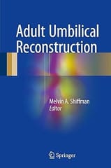 Adult Umbilical Reconstruction Principles And Techniques 2017 By Shiffman M A