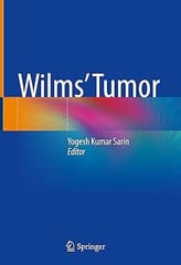 Wilms Tumor 2022 By Sarin Y.K.