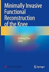 Minimally Invasive Functional Reconstruction Of The Knee 2022 By Zhao J.