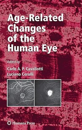 Age-Related Changes Of The Human Eye 2008 by Cavallotti C.A.P.