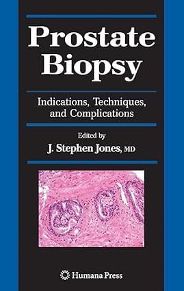 Prostate Biopsy 2008 by Jones J.S.