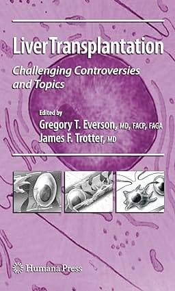 Liver Transplantation 2008 by Everson G. T.