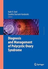 Diagnosis And Management Of Polycystic Ovary Syndrome 2009 by Farid N. R.